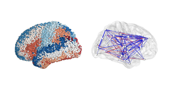 Brain mapping from the Penn-led Restoring Active Memory project. 