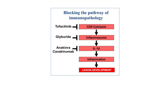 Leishmaniasis pathway Leishmaniasis pathway