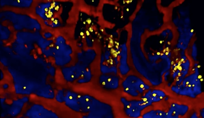 Plasma cells Plasma cells