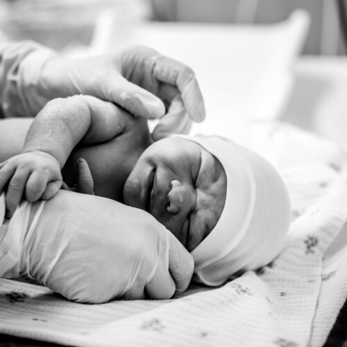  A premature baby wearing a hat is laying down in a medical setting with medical personnel wearing latex gloves touching the baby’s head