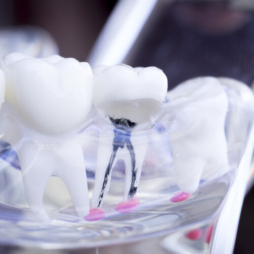A dental model of teeth.