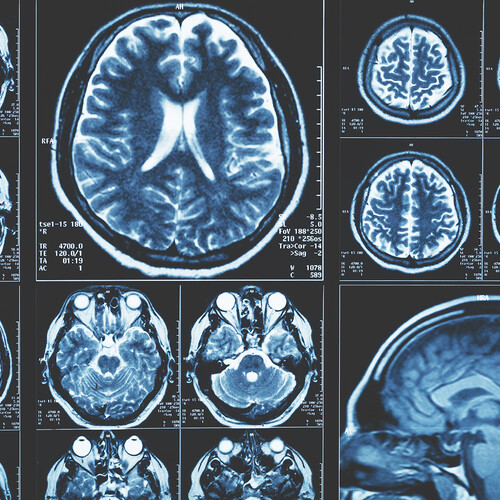 Results of a brain scan.