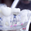 A dental model of teeth.