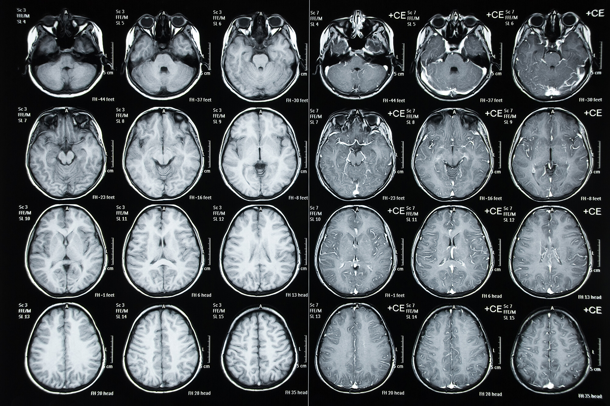 Sheet of a child’s brain scans.