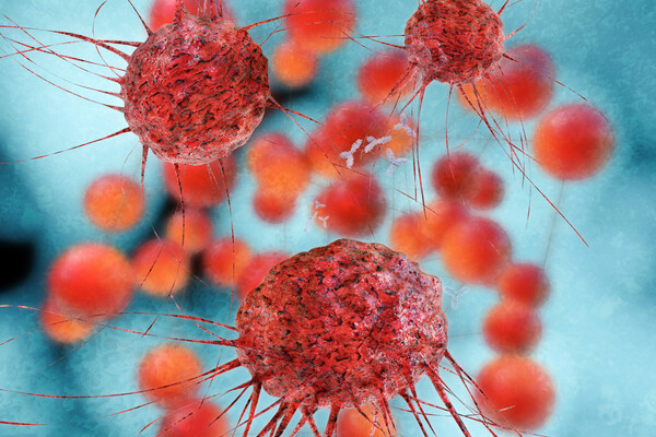 cancer_cells