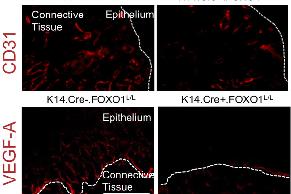 Researchers from Penn Dental Medicine found that the molecule Foxo1 plays a critical role in the wound-healing process. 