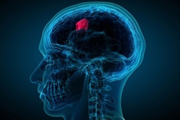 brain_tumor