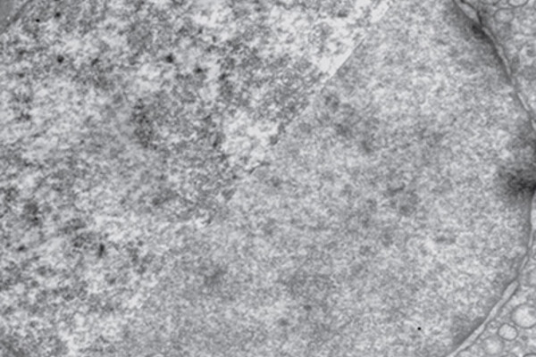 side-by-side comparison of two nuclei with different compaction