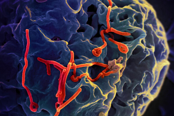 ebola virus through the microscope