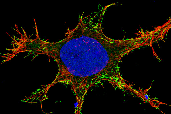 ebola virus through a microscope