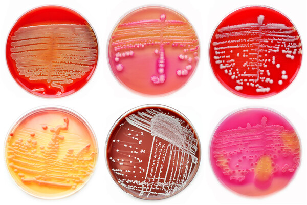 six agar plates with different types of bacteria growing on them