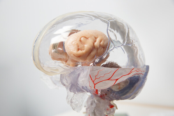 A model of the internal brain hemisphere under a glass skull.