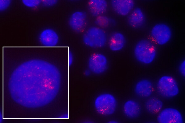 Microscopic images of cells are blue with diffuse splotches of pink on each cell.