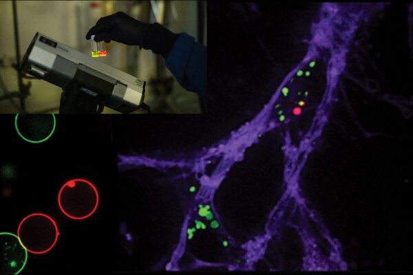 a neuron with colored dots showing where protein aggregates form; there is also an inset image showing a hand holding up two glowing vials in front of a UV light