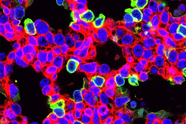 CRISPR-edited lung cells (green) with EGFP fluorescent protein. 