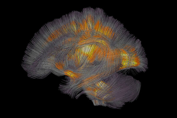 Abstract rendering of brain areas being activated by lighting up.