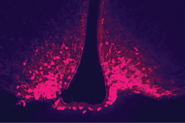 Purple and pink illustration of a neuron synapse
