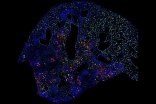Colorful fluorescent labeled cells appear in a tissue sample of a lung