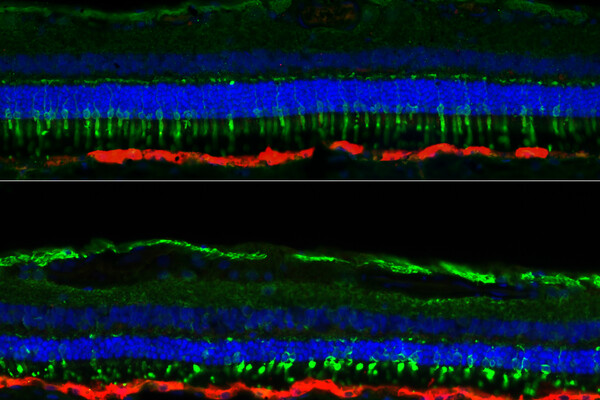 Top-and-bottom show fluorescent, microscopic images of layers of the eye's retina in blue, green, and red.
