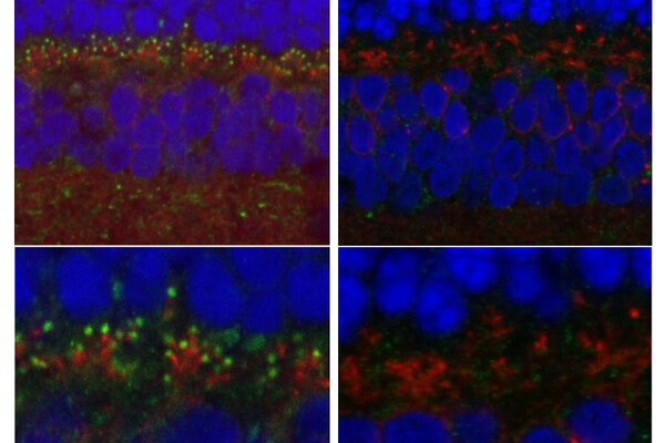 four panels of cellular molecules highlighted by fluoroscopy. Right panels show fewer bright green dots but otherwise look similar to those on the left.