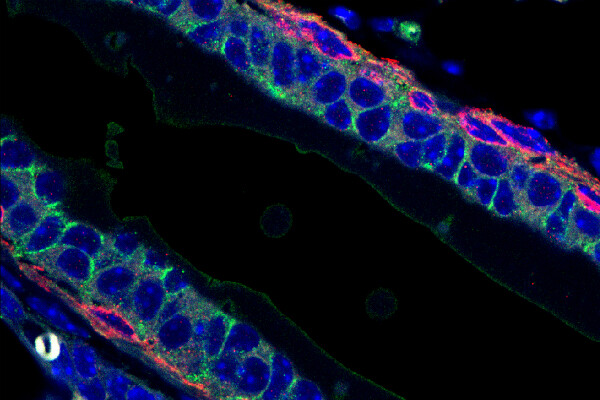 microscope images of a mammary gland duct