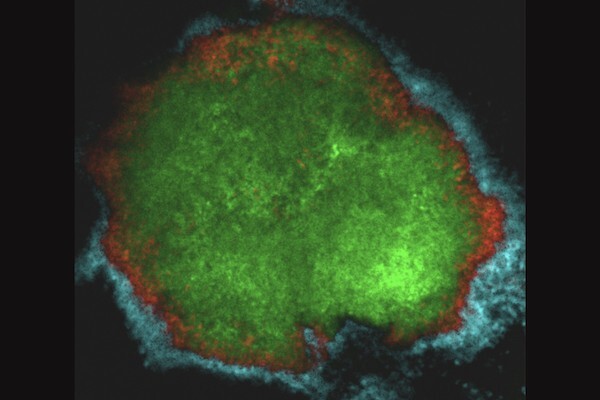 Microscopic image of a bacterial growth labeled with green, red, and blue fluorescence