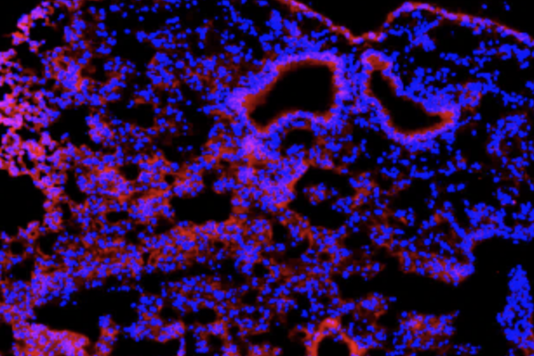 Fluorescent microscopic image of lung tissue stained in blue and pink