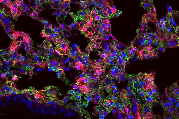 Microscopic view of  lung cells expressing the synthetic mRNA 