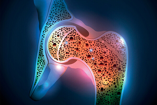 Neon microscopic rendering of a bone joint.