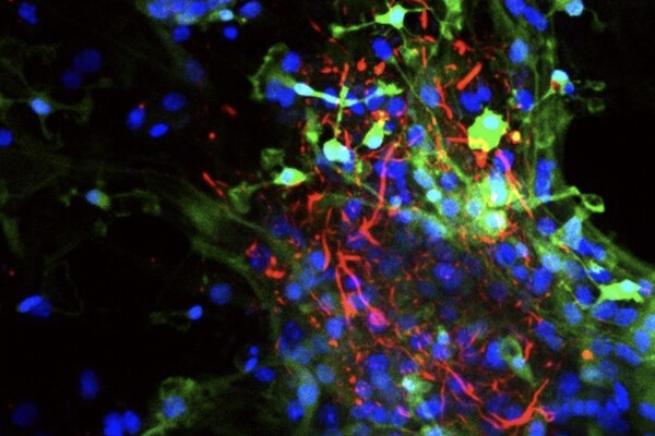 A close of a neuron with green, red, and blue fluorescent labeling
