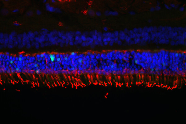 microscopic image of retinal tissue layers labeled in red and blue