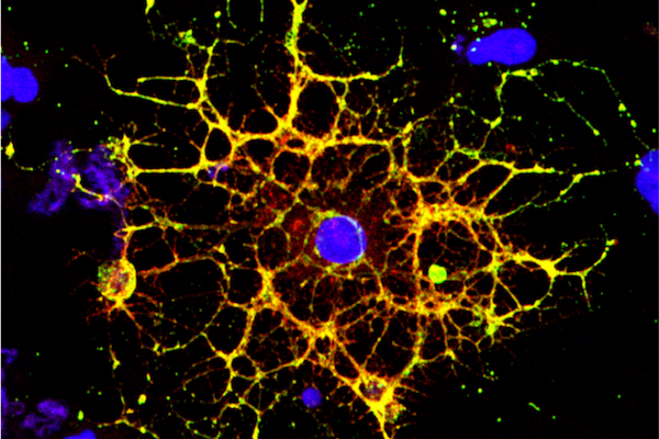 Fluorescent microscopic image of a brain cell stained in blue and yellow