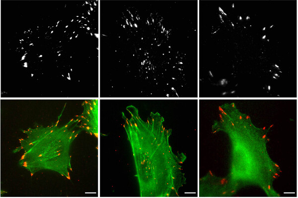 six panels showing cells in green with protein involved in cell movement labeled in red