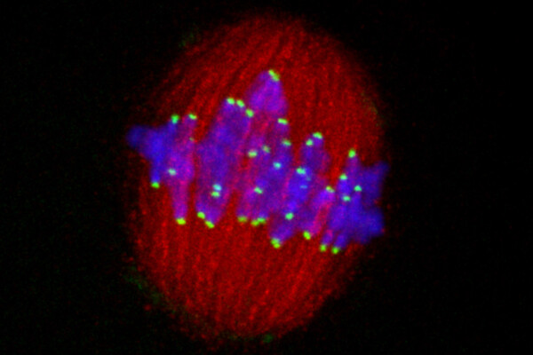 A cell undergoing division with chromosomes labeled with fluorescent markers
