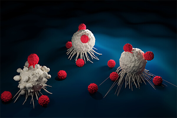 microscopic rendering of three solid tumors being attacked by CAR T cells.