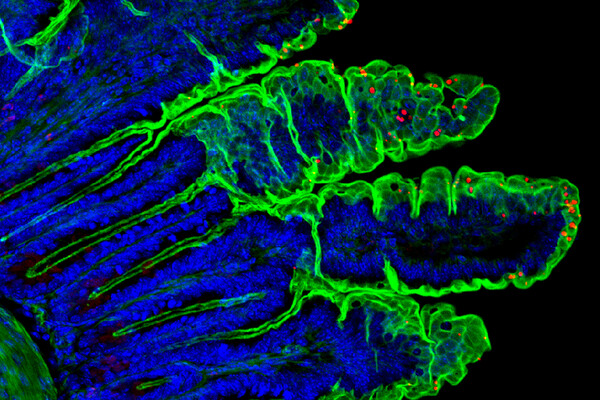 Cryptosporidium