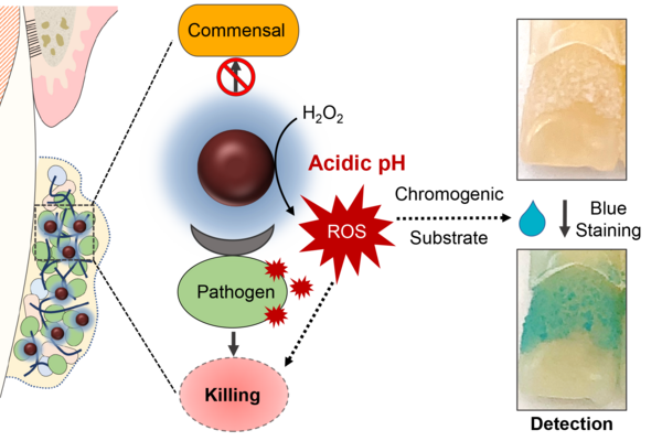 diagray showing how a nanoparticle can respond to bacteria in the mouth and kill pathogens