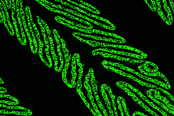 Microscopic image of fluorescently labeled lamellae in a horse hoof