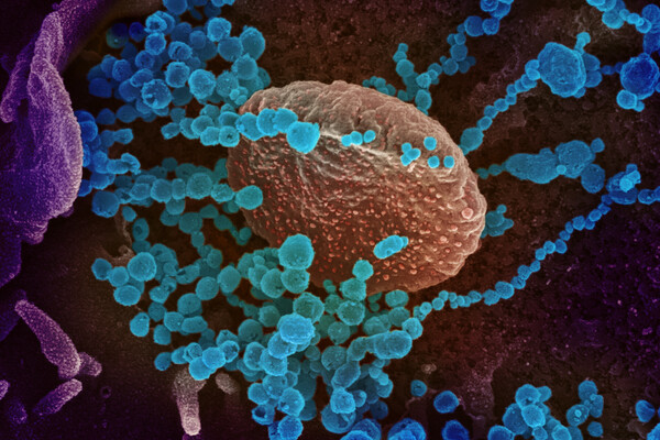 Microscopic view of numerous particles of SARS-CoV-2 labeled blue emerging from an infected cell.