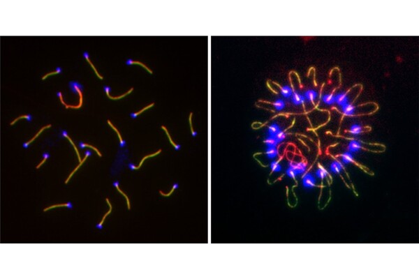 Side by side images show abnormal clustering of chromosomes, labeled with florescent purple and yellow