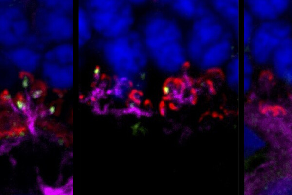 Three panels show fluorescent images of therapeutic gene LRIT3, which corrects a form of night blindness