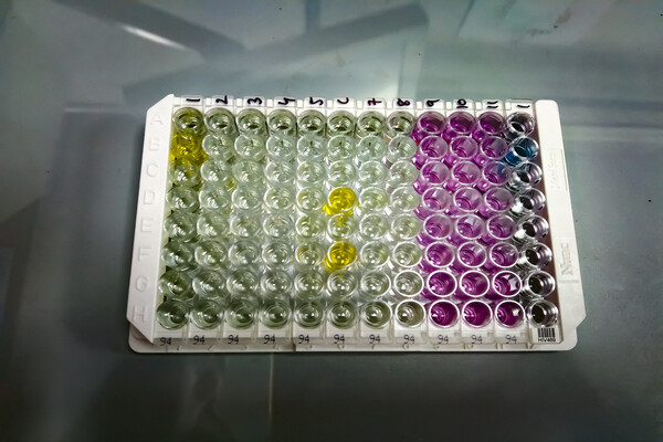 Tray of vials used for hepatitis c screening.