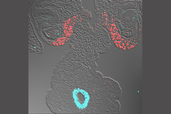 microscopic image with proteins labeled in red and blue shows tissue that develops into the adrenal glands
