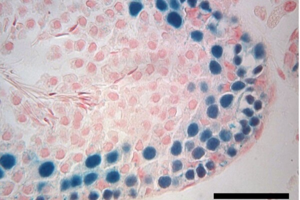 Cross-section of testes tissue shows a variety of cells labeled pink and blue and sperm