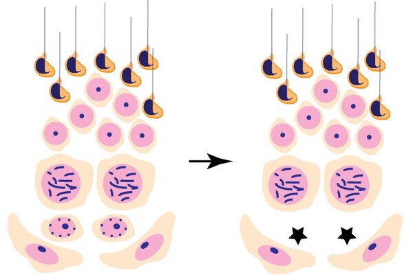 Illustration of different cell types that eventually give rise to sperm shows that blocking an early stage of cell development can prevent the formation of sperm