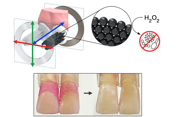 Graphic shows how nanoparticle-based microrobots can remove dental plaque from teeth with their motion and the activity of hydrogen peroxide (H2O2) to kill microbes