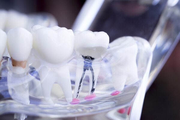 A dental model of teeth.