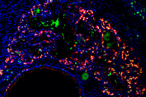 Microscopic image of lung with cells labeled in blue, red, and green