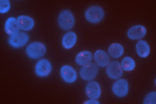 Lung cells with RNA labeled in pink in each cell