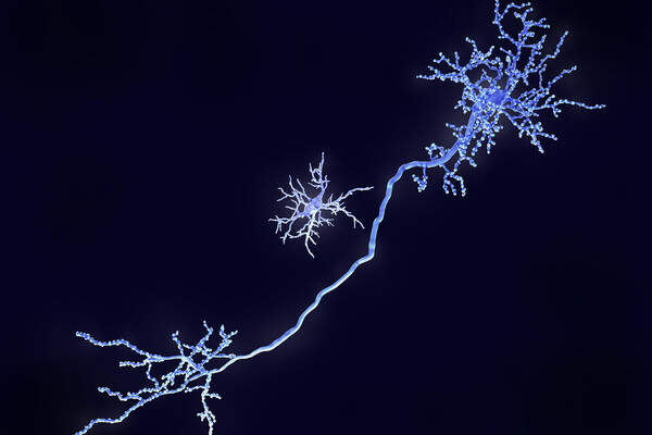 Microscopic view of Microglia cell and pyramidal neuron.